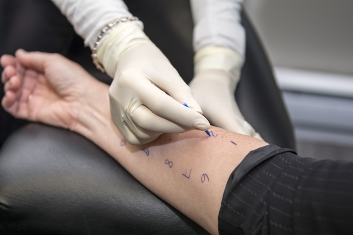 allergie Allergie - Lacroix