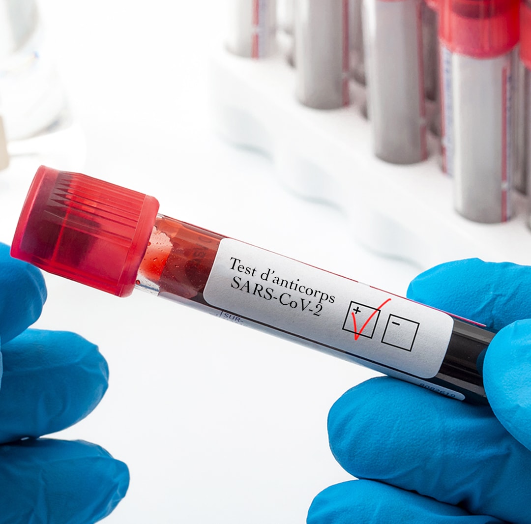 Test d'anticorps - V2