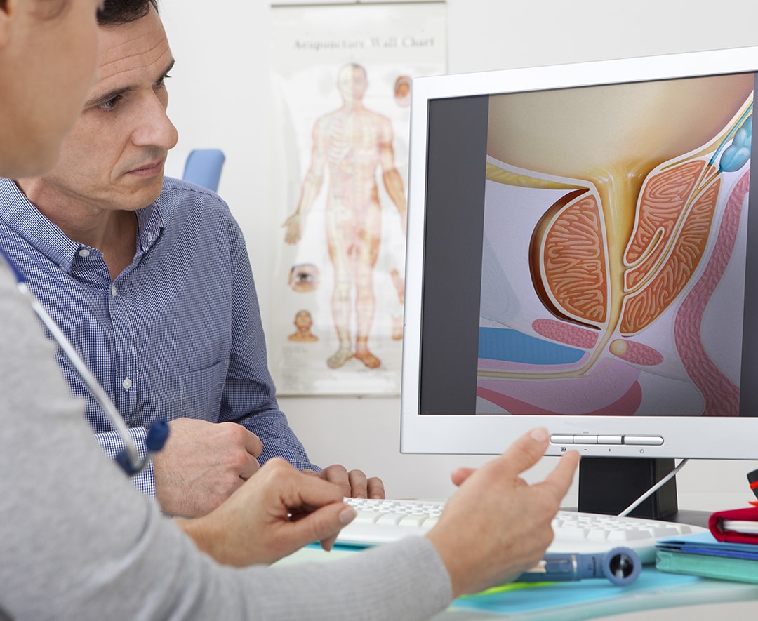 Urologie - Image médecine patient prostate Urologue privé